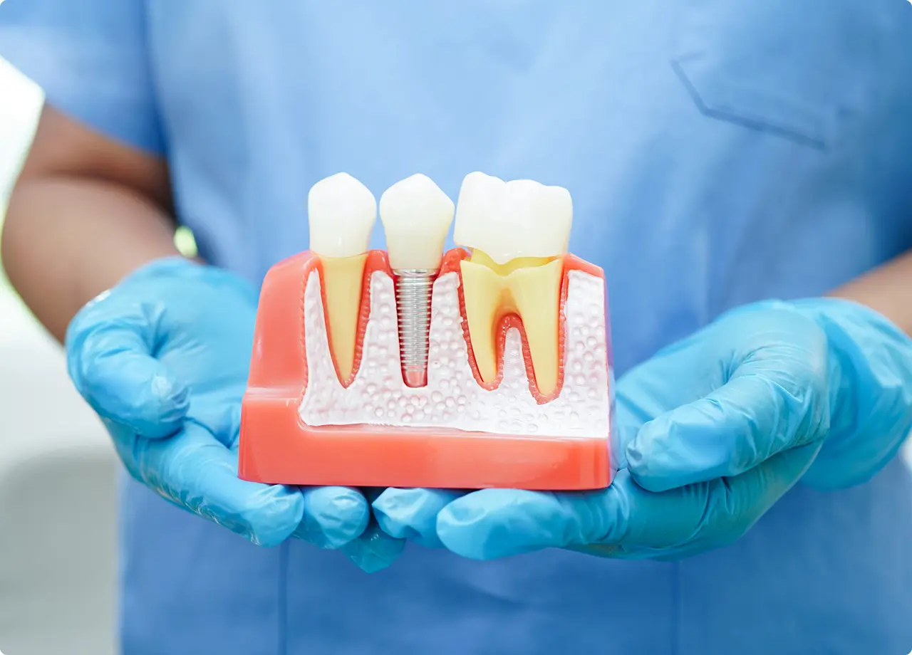 Dental model held by gloved hands.